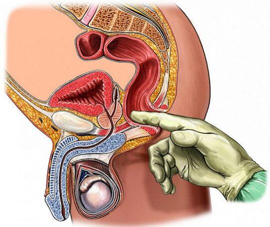 Diagnostic de prostatite