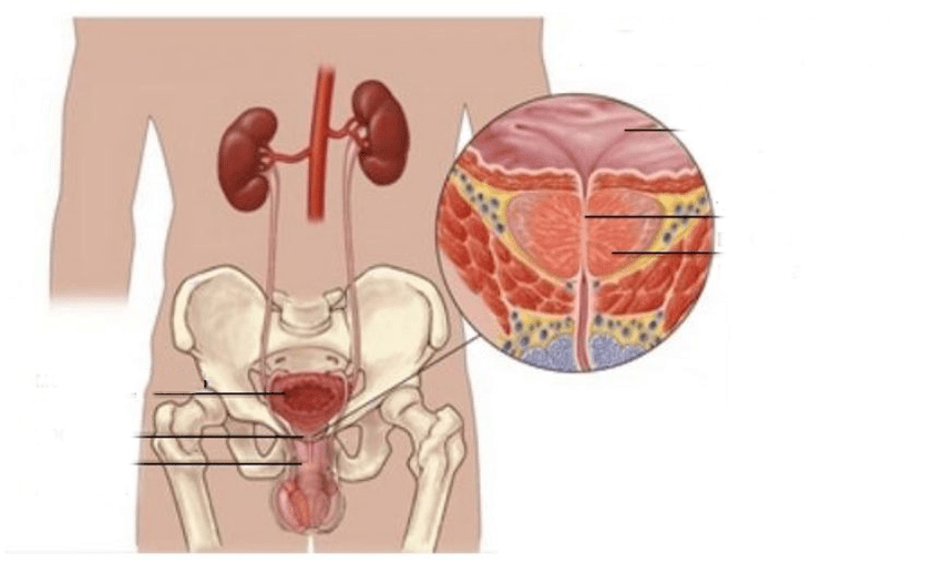 prostatite chez les hommes