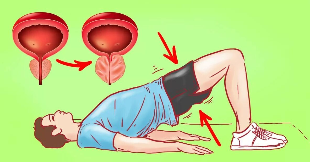 Exercices pour la prostatite